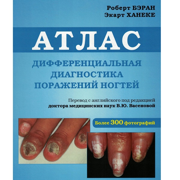 Атлас диагностика поражения ногтей