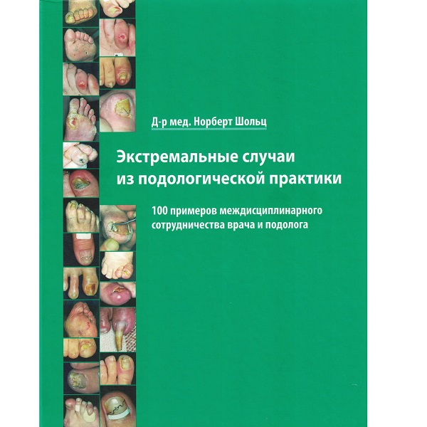 Экстремальные случаи из подологической практики
